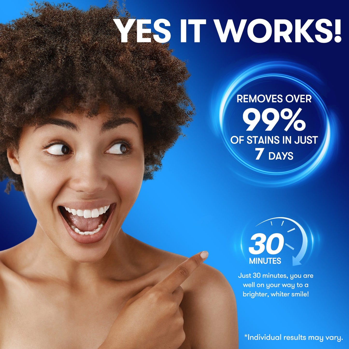 MySmile Teeth Whitening Strips