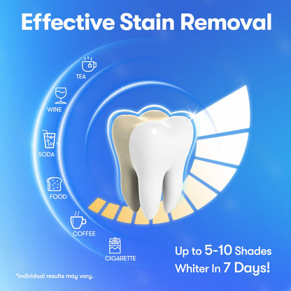 MySmile Teeth Whitening Strips